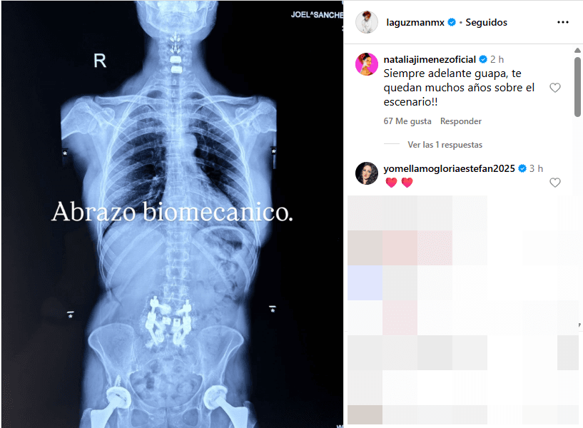 Alejandra Guzmán compartió una fotografía donde se pueden ver su columna y cadera tras las operaciones.