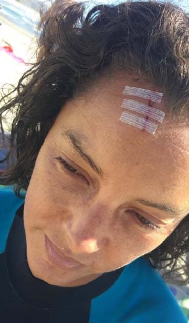 Después de la curación, todo volvió a la normalidad y Sara siguió disfrutando de sus vacaciones.