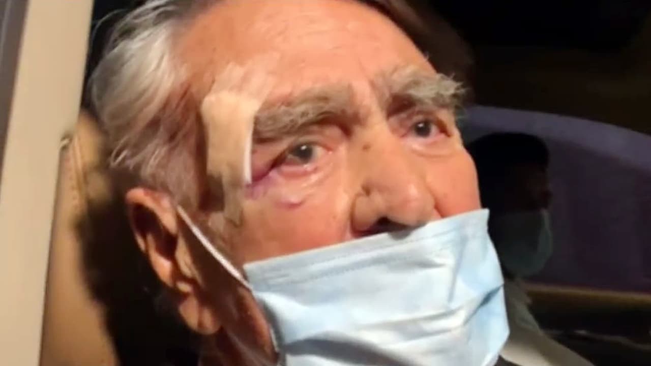 El accidente le provocó una 
<b>fractura de costilla y fuertes golpes en las manos y el rostro</b>, de las cuales sigue recuperándose.