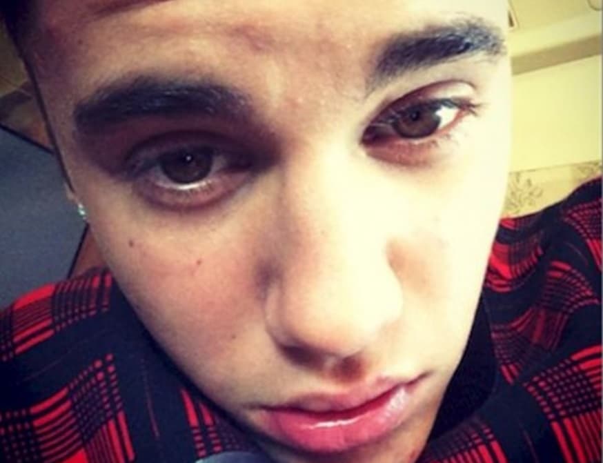 El rey del escándalo, Justin Bieber, cometió el error de tomarse este fatal 'close up'.