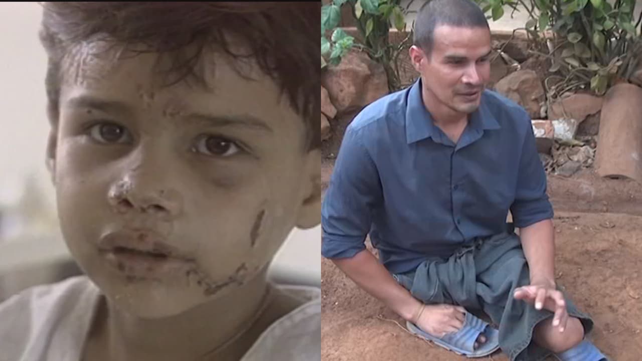 Un tren le cortó las piernas a los 5 años: 25 años después pide ayuda para unas prótesis