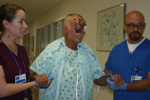 Ronald Poppo, ahora de 65 años, fue atacado por Rudy Eugene mientras estaba sentado en una vía pública de Miami.