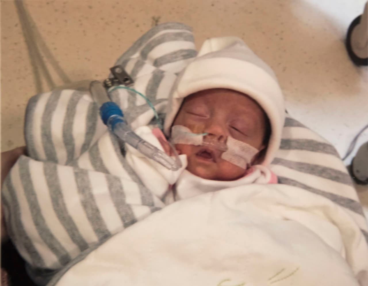 Seis semanas después fue cuando dio a luz, sorprendiendo a su novio, Chris Hutcheson, de 21 años. La bebé necesitaba una operación de emergencia.