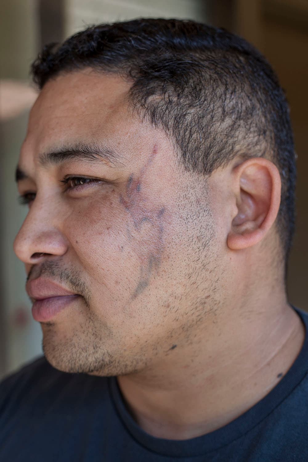 Las dos principales razones por las que hombres y mujeres visitan Sunrise Center es porque quieren conseguir un trabajo y no lo han logrado por sus tatuajes o porque quieren ser padres y desean dar un buen ejemplo a sus hijos.