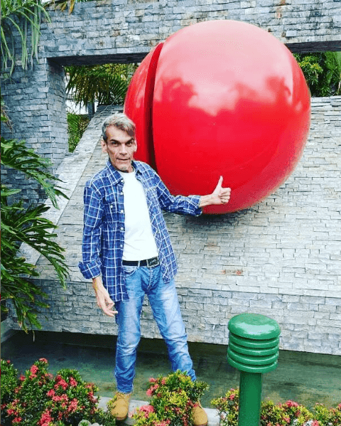 Incluso, la cirugía de amputación se retrasó, también, por supuesta discriminación, según dijo su abogado al medio venezolano.