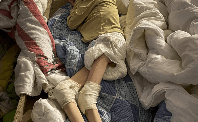 El escándalo de las "casas del terror": discapacitados vivían en un sótano cubiertos de heces y orina, y sin ver la luz