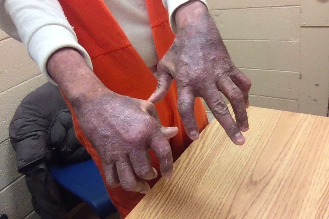 Inmigrante denuncia a ICE por no darle sus medicinas.