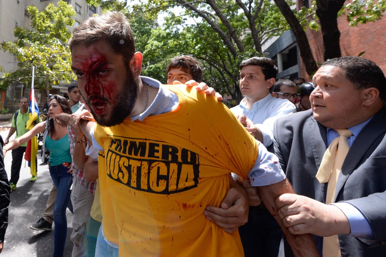 Siete asambleístas opositores apaleados en Venezuela por fuerzas afines a Maduro