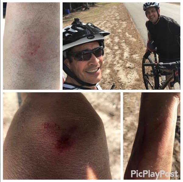 Sin embargo, no es su primer accidente. En su cuenta de Instagram ha compartido más imágenes de sus aventuras en bicicleta.