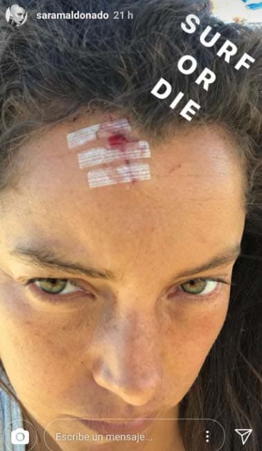 La actriz compartió las fotos del incidente y, como se puede ver, requirió que le suturaran la herida.