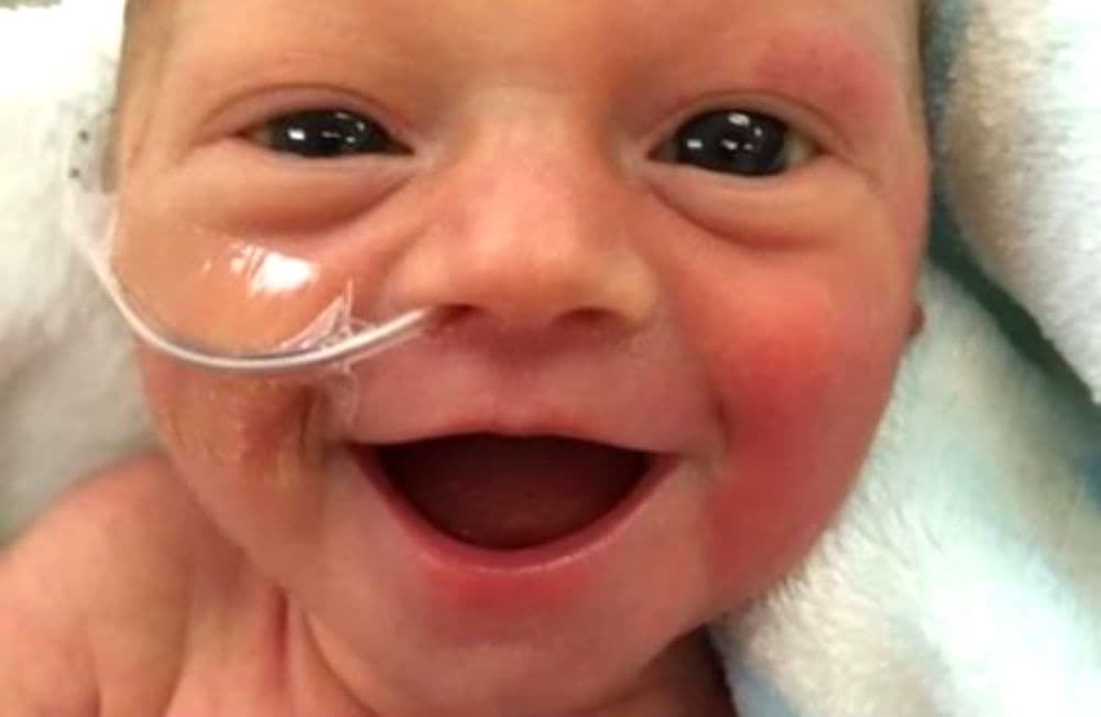 Viral: foto de bebé prematura sonriendo tiene encantados a miles