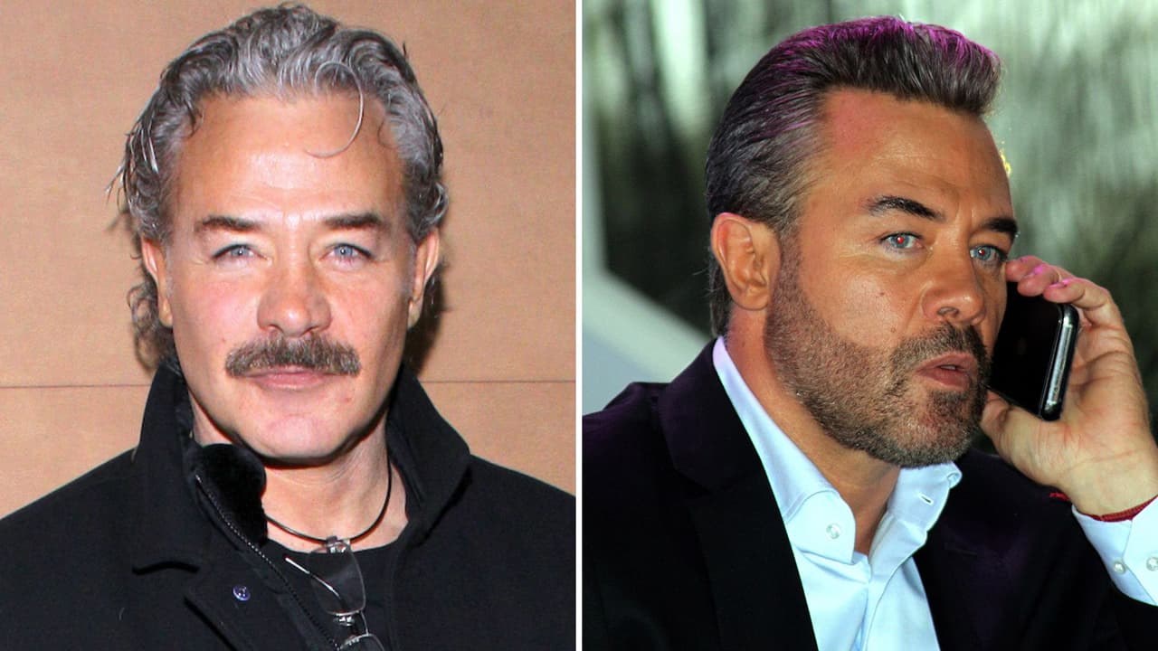 ¿Por qué Sergio Sendel tiene un hoyito en la oreja?: la historia del accidente que terminó en injerto