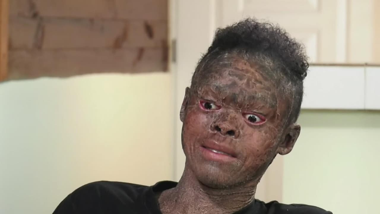 <b>Mira el caso completo aquí </b>