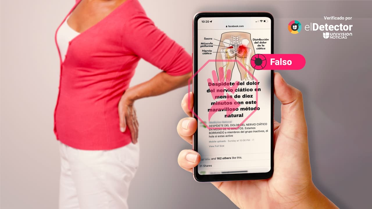 El dolor del nervio ciático NO se elimina en menos de 10 minutos, como dice esa publicación en redes