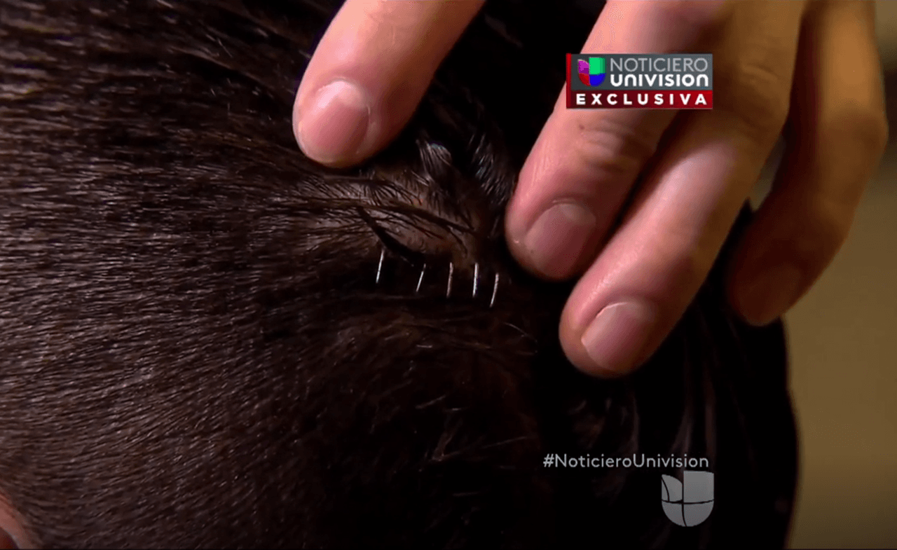 “Nos dijo que éramos una basura”: el mexicano lanzado a las vías del metro por un hombre con la gorra de Trump