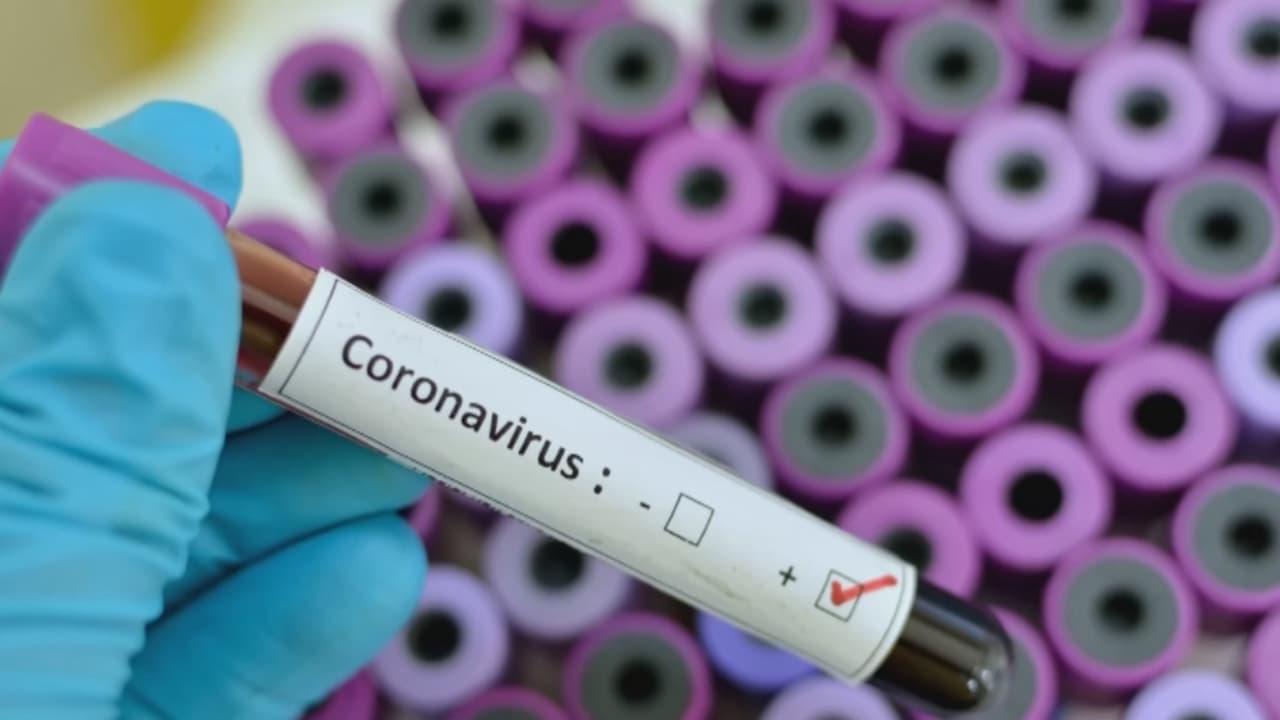 Se trata de una inflamación vascular, similar a la que produce la enfermedad Kawasaki y los Centros para el Control de Enfermedades, CDC, han confirmado que el síndrome está asociado al coronavirus.