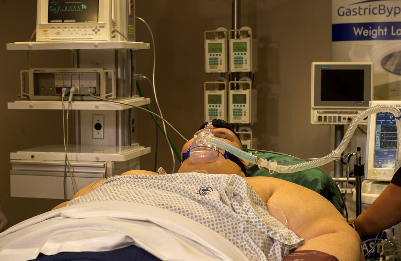 <b><a href="https://www.univision.com/noticias/obesidad/el-hombre-mas-obeso-del-mundo-que-llego-a-pesar-mas-de-1-000-libras-esta-listo-para-ser-operado-en-mexico">En mayo de 2017 entró por primera vez al quirófano</a></b> para realizarse una manga gástrica y, seis meses después, le hicieron una conversión a bypass.