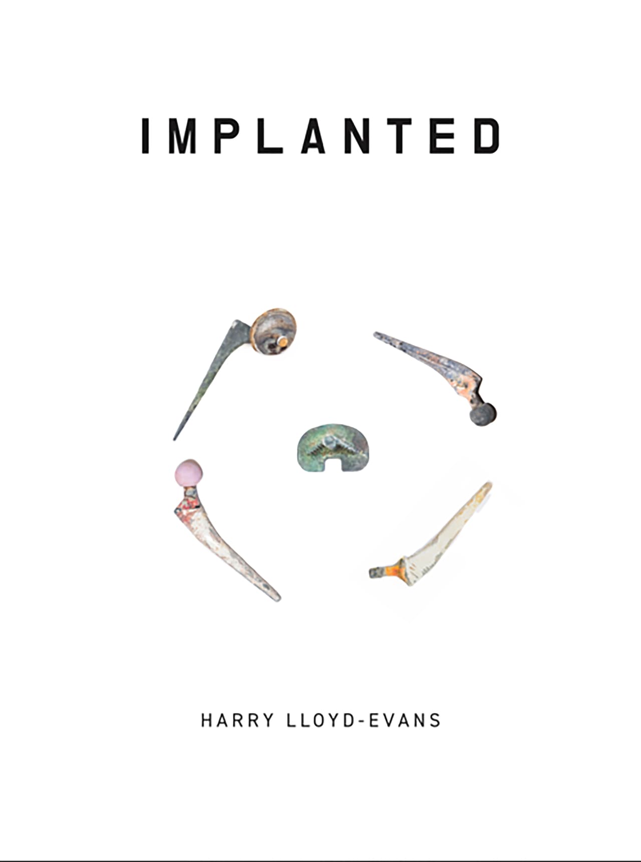 Implanted fue el último proyecto de Lloyd-Evans para la universidad de Falmouth en Reino Unido y se convirtió en un libro de 32 páginas 
<a href="http://harrylloydphotos.com/shop/">que se puede comprar en el sitio web del artista</a>. “Tardé unos 8 meses en llegar a esta etapa, pero mi plan es continuar con este proyecto en el futuro. Hay mucho más para explorar dentro de este proceso”, concluyó el fotógrafo.
