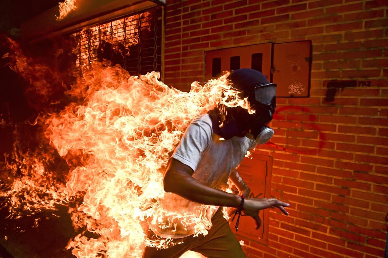<b>Manifestante en fuego. </b>José Salazar Balza, uno de los cientos de jóvenes que han protestado enérgicamente contra el gobierno en Caracas, Venezuela, incendió su cuerpo accidentalmente en un enfrentamiento contra la policía el 3 de mayo de 2017. El fotógrafo venezolano de la agencia Agencia France Press Ronald Schemidt fue uno de los periodistas que 
<a href="https://www.univision.com/noticias/crisis-en-venezuela/en-fotos-arrecia-la-violencia-y-represion-en-venezuela-durante-las-protestas-fotos">captó un instante que impactó al mundo. </a>