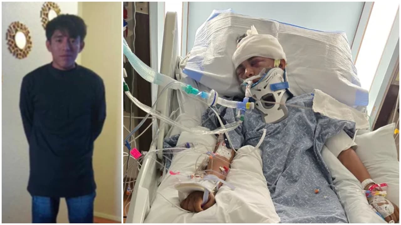 Joven guatemalteco queda en coma tras recibir una golpiza cuando salía de su trabajo en Los Ángeles