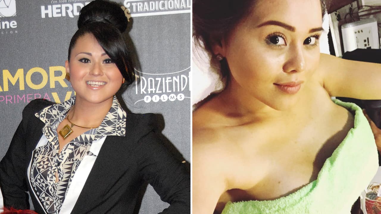 'Gomita' le teme al bisturí después de ocho cirugías: te contamos qué le dijo el doctor