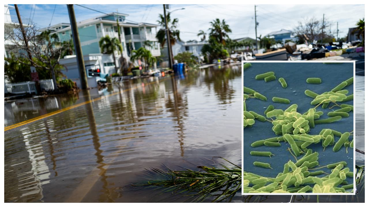 Casos de la bacteria ‘come carne’ se disparan en Florida tras impacto de Helene y Milton