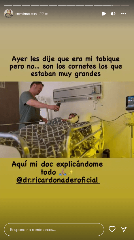 A pesar de que se la hizo por una cuestión estética, explicó que su doctor aprovechó para reducirle los cornetes "con radiofrecuencia" y así pudiera respirar mejor.
<br>