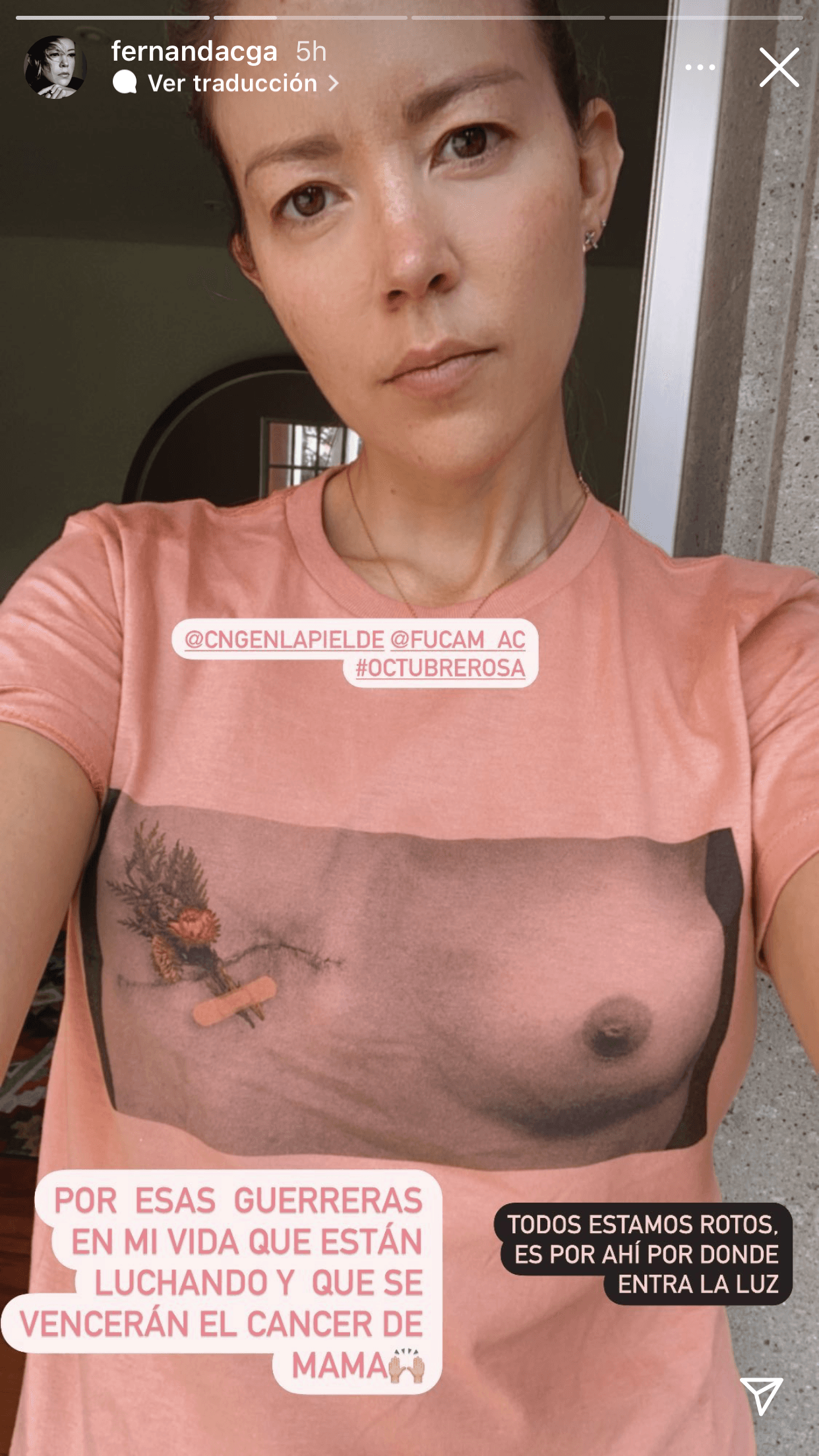 En el caso de Castillo, ella colgó la foto luciendo la camiseta a través de sus historias de Instagram con un mensaje de aliento a las "guerreras" que "están luchando" contra esta enfermedad. 
<br>