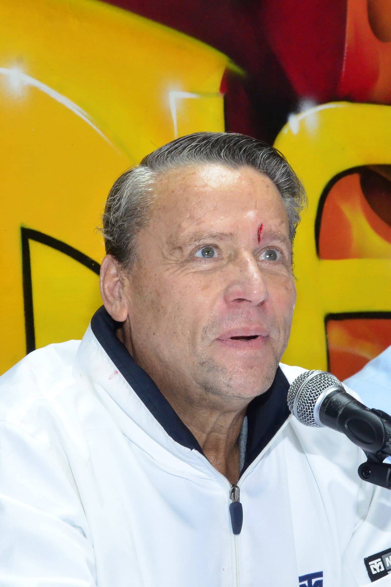 Esto se debe a que Trejo le aventó una botella con agua a Adame, propinándole un golpe en el rostro que le provocó una 
<b>herida en la ceja</b> que podría impedir que el actor participe.