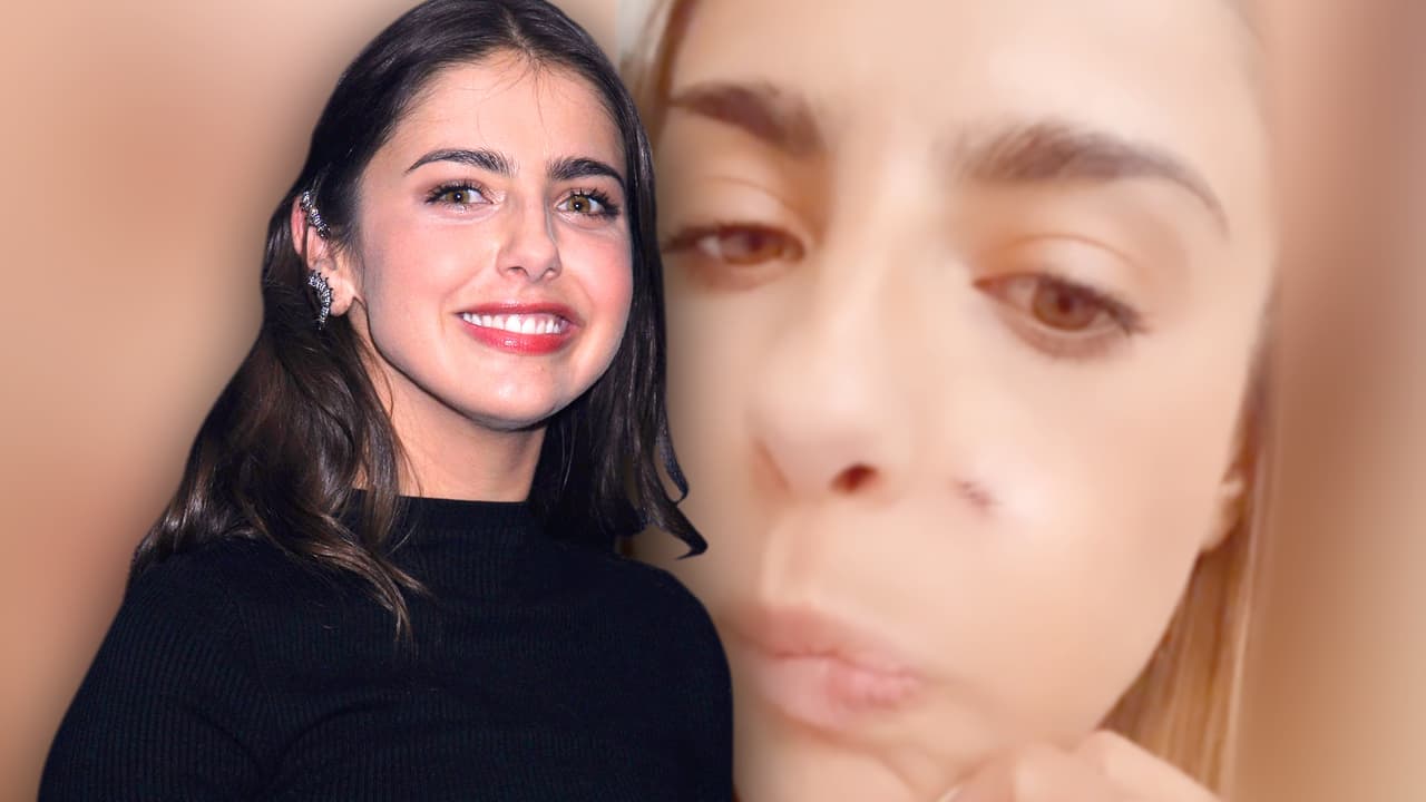 Michelle Renaud aclara qué le pasó en el rostro tras recibir más mensajes que cuando terminó con Danilo Carrera