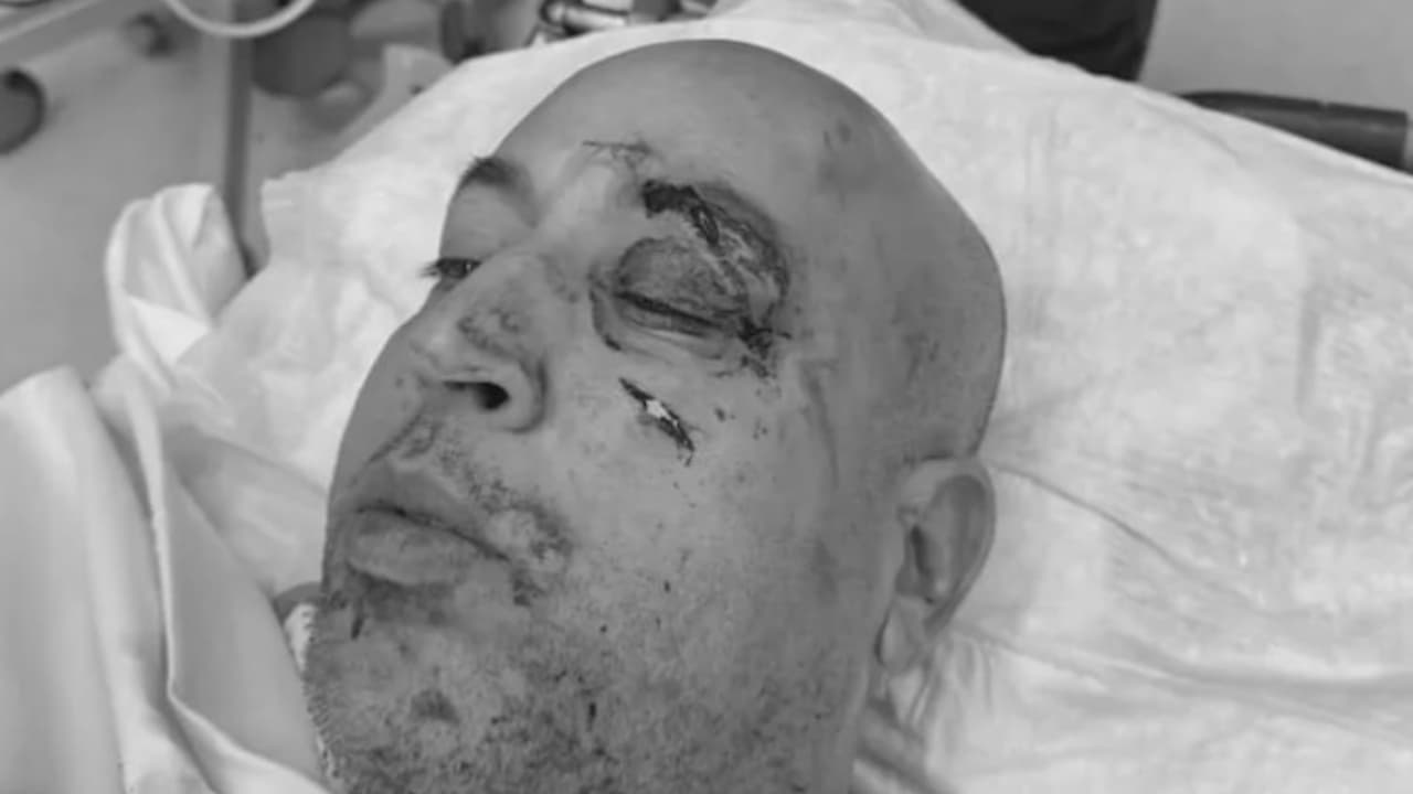 Teniente hispano de NYPD es agredido al intentar detener una pelea en el subway 