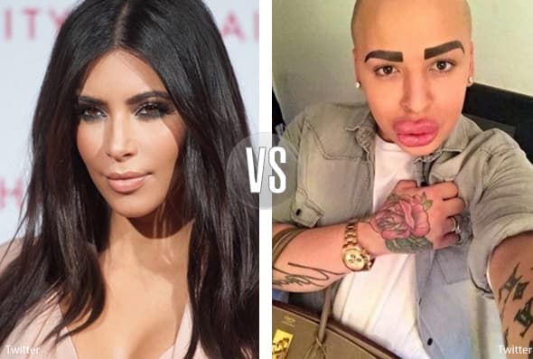 Otros fanáticos como Tobias también se operaron para verse como sus ídolos. Tremendo susto que nos llevamos al enterarnos que un fan de Kim Kardashian quería parecerse a la socialité y cantante.