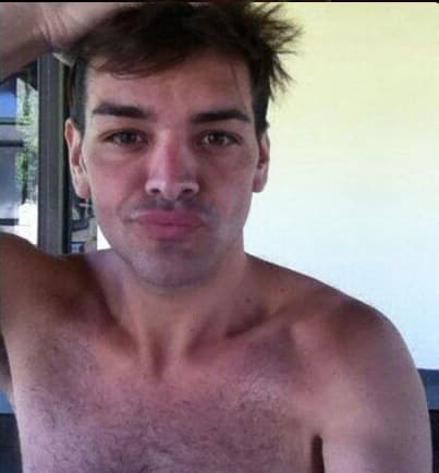 Pero Fran se hizo adicto a las cirugías, hasta el momento lleva cuatro para lograr parecerse a Ricky.