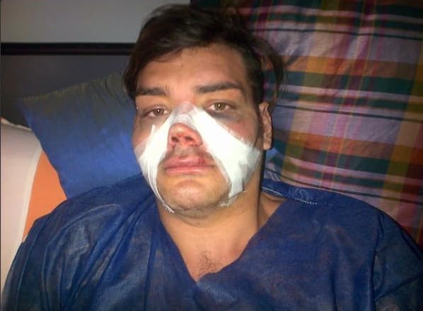 Este joven se llama Fran Mariano y se sometió a diferentes cirugías para parecerse a Ricky Martin.