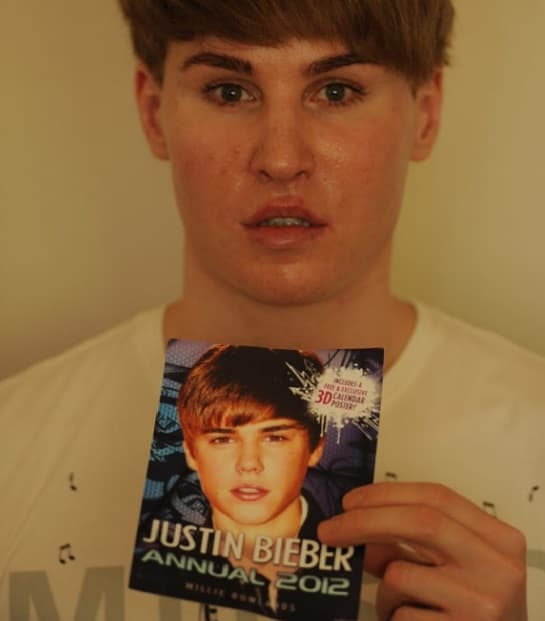 El hombre, quien gastó más de $100 mil dólares para verse como el canadiense, tenía muy preocupados a sus amigos. Ellos dijeron que no era usual que Tobias desapareciera sin avisarles donde estaría.