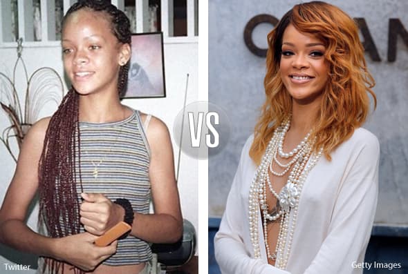 El cambio es súper evidente.