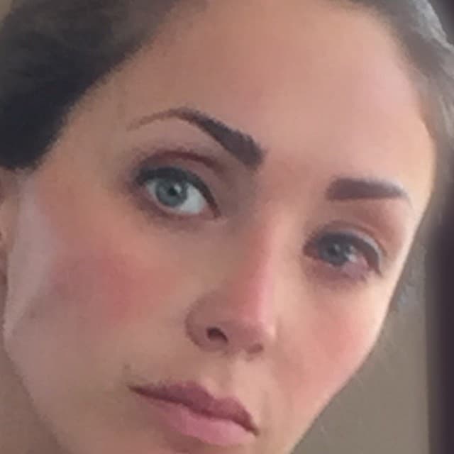 Incluso lo compartió con sus seguidores en Instagram cuando tuvo una afección en el ojo.