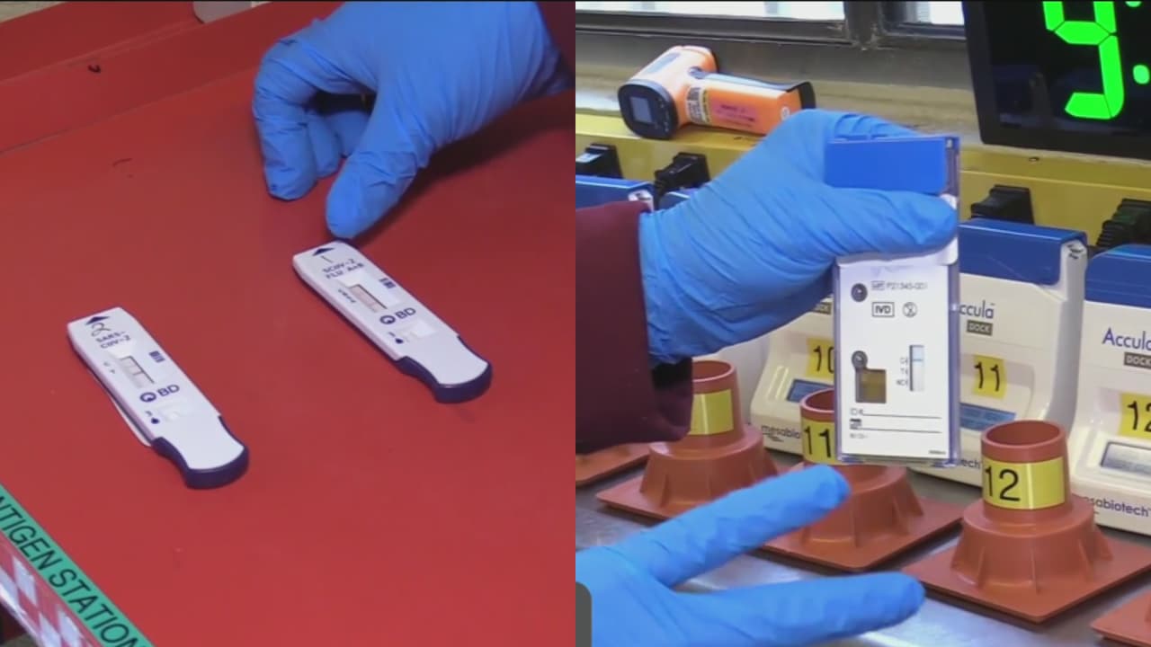 Paso a paso: Así es como expertos procesan las pruebas del coronavirus en los laboratorios