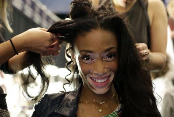 Desde su aparición en el modelaje Winnie Harlow rompió con los estereotipos y aún sigue haciéndolo.