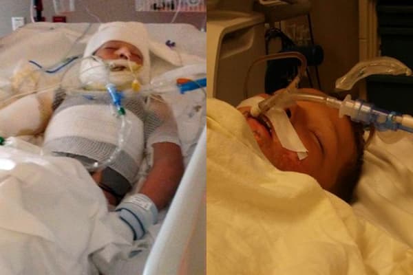 Niño discapacitado sufre quemaduras en Texas presuntamente víctima de acoso de otros menores