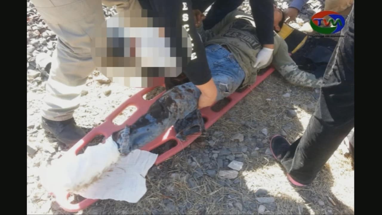 Andrés sufrió la amputación de una pierna y perdió parte de un pie. Los rescatistas lo llevaron de urgencia al hospital.