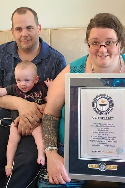 Ese día, la organización
<a href="https://www.guinnessworldrecords.com/news/2021/6/worlds-most-premature-baby-given-0-odds-of-survival-celebrates-first-birthday-663394" target="_blank">Guinness World Records</a> le entregó el reconocimiento como el bebé más prematuro que ha sobrevivido.