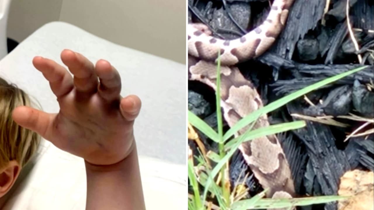Serpiente cabeza de cobre muerde a un niño en una guardería en Carolina del Norte