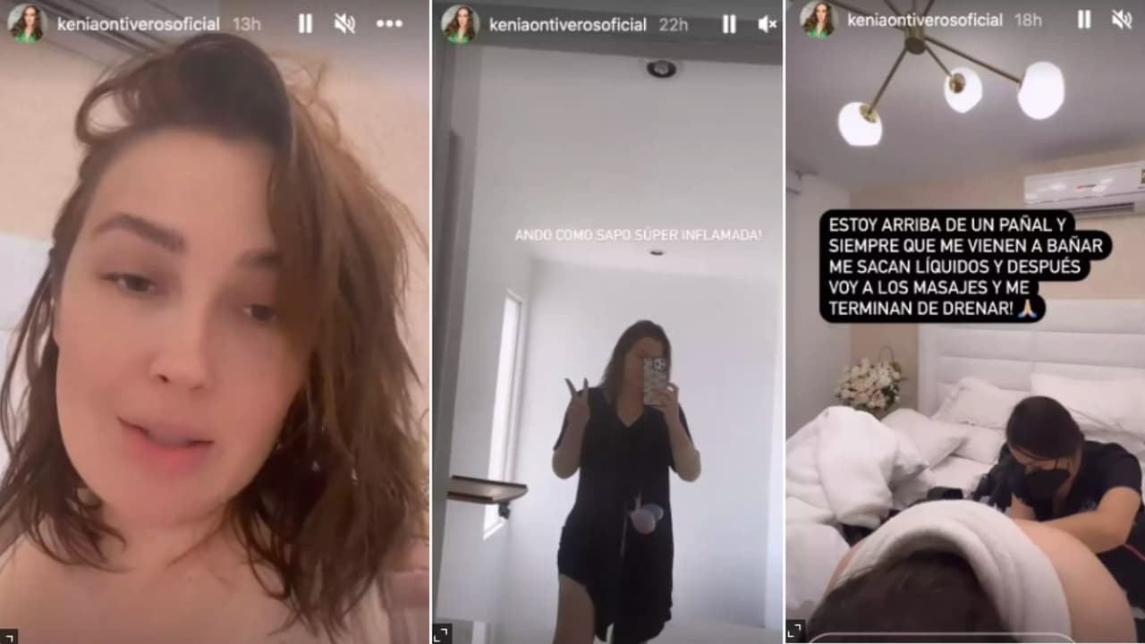 Kenia Ontiveros vive un duro proceso de recuperación tras cirugías estéticas.