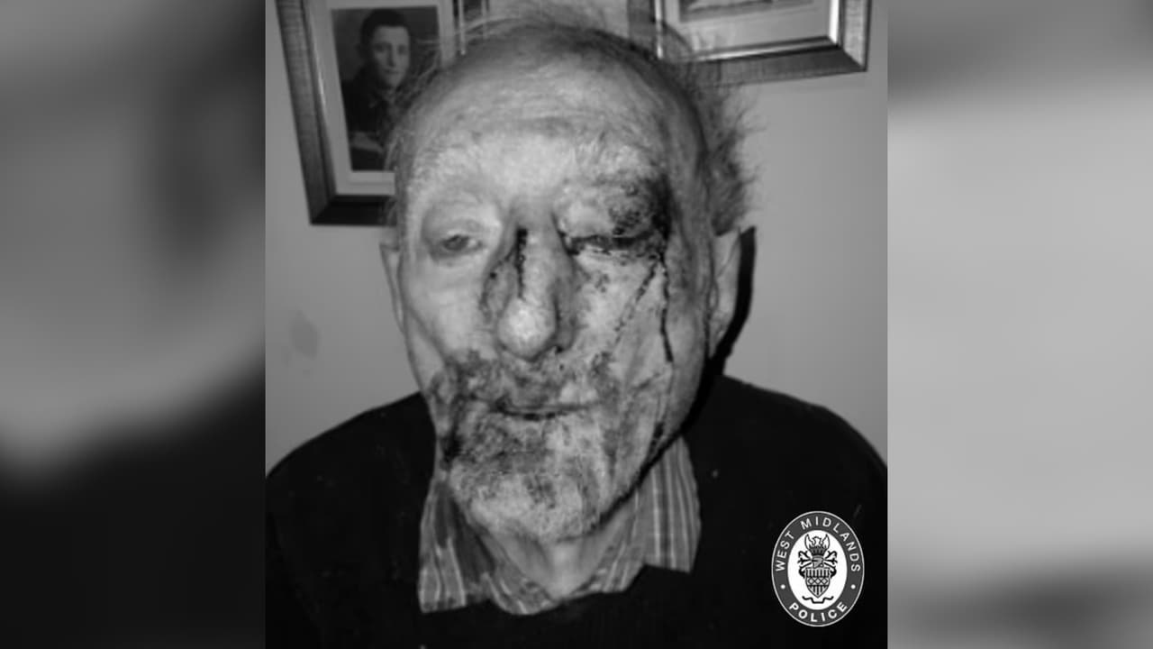 Un jubilado de 87 años es brutalmente golpeado por una mujer adicta a las drogas que lo asaltó en su propia casa 
