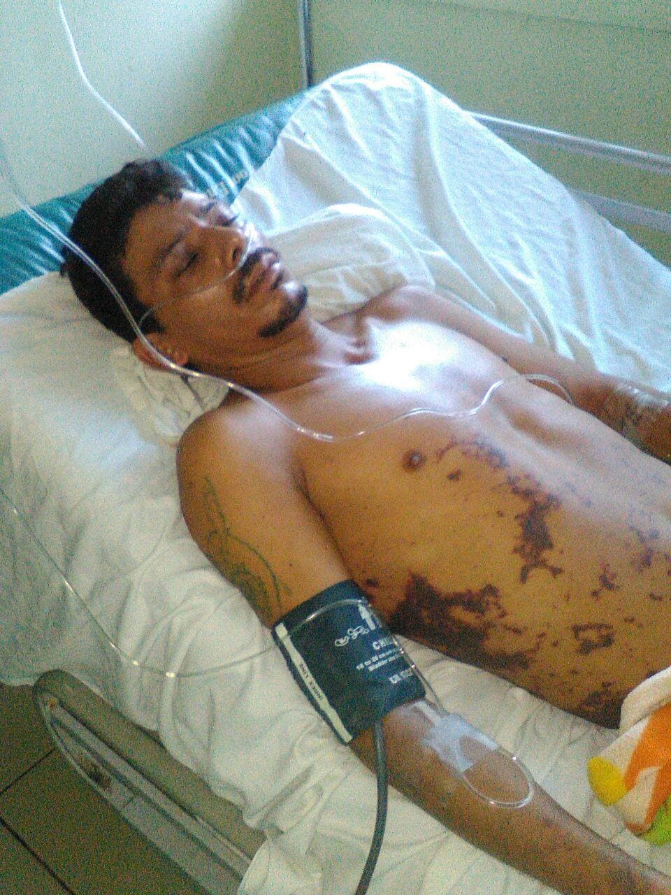 Cómo un campesino nicaragüense acabó sin piernas por la brutalidad policial y un error de su acusador 