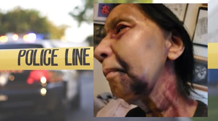 La hispana, identificada solo como Becky, sufrió lesiones en su cabeza, una fractura en su nariz, moretones en toda la cara, además le arrancaron mechones en su cabello durante el ataque, dijo su hijo Pete.