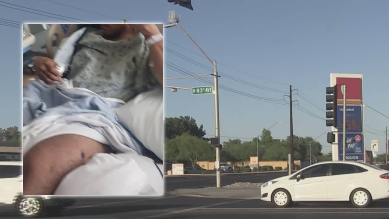 Le disparan a un joven desde un vehículo en Glendale y luego se dan a la fuga