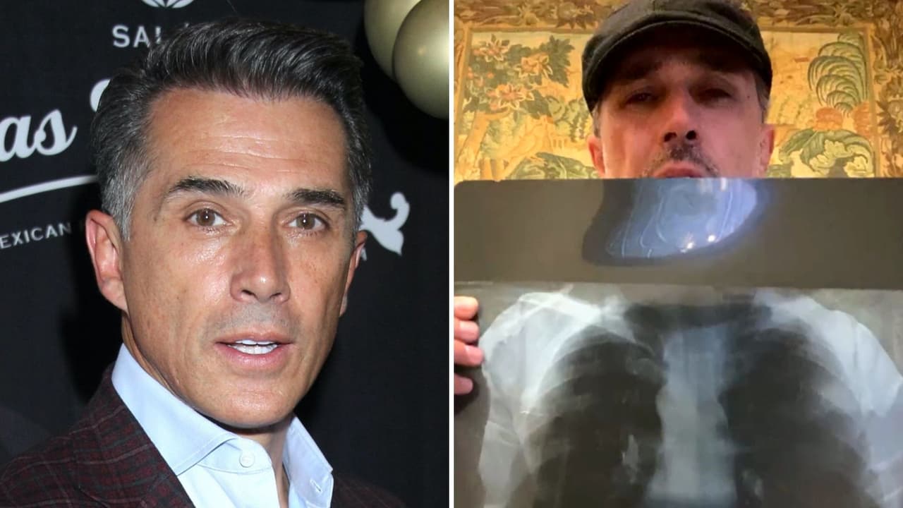 "Me duelen los pulmones": Sergio Mayer explicó su nuevo problema de salud (no es covid)