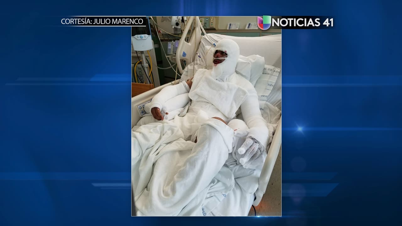 Así se recupera el hispano pateado por la policía mientras se quemaba en Jersey City